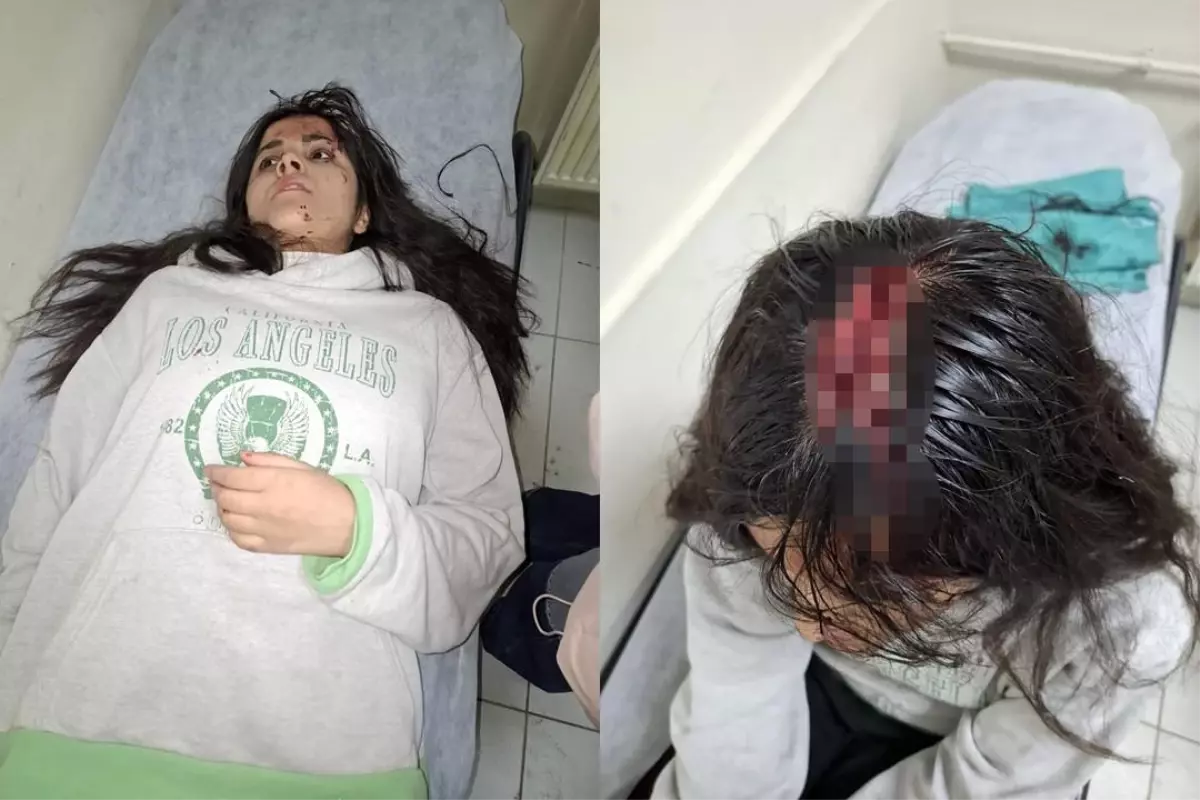 Hakkari’de Buz Kütlesi Genç Kızı Yaraladı